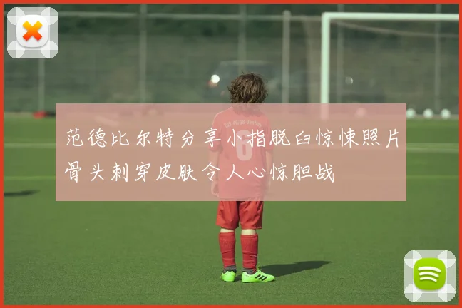 范德比尔特分享小指脱臼惊悚照片骨头刺穿皮肤令人心惊胆战
